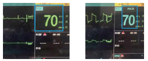 圖2 心率脈率顯示